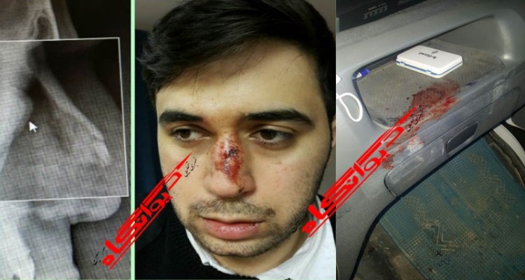 کتک کاری و شکسته شدن بینی همکار فوریت های پزشکی هرسین در حین انجام مأموریت/ به آمبولانس هم خسارت وارد شده است
