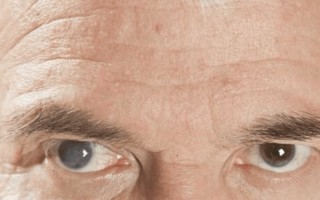این علائم در چشم را جدی بگیرید