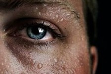 تعرق زیاد خبر از کدام بیماری‌ها می‌دهد؟ 