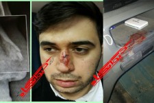کتک کاری و شکسته شدن بینی همکار فوریت های پزشکی هرسین در حین انجام مأموریت/ به آمبولانس هم خسارت وارد شده است